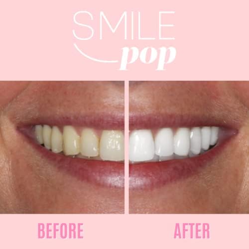 Насмевка поп премиум заби за белење на гел шприц на нане, три 3мл 35% карбамид пероксид - помага да се отстранат флеките на