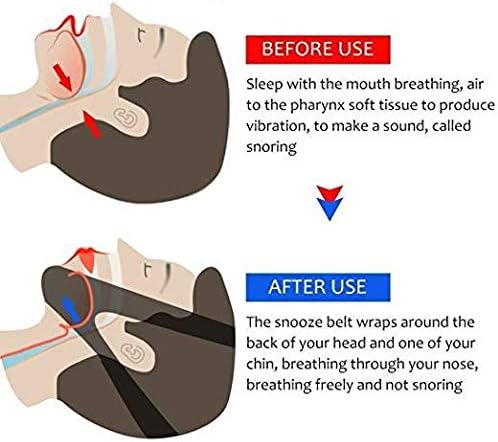 Ванвен Престанете Да 'Рчите CPAP Ремен За Брадата И Раствор Против' Рчење, Прилагодлив Уред За Поддршка Против ' Рчење