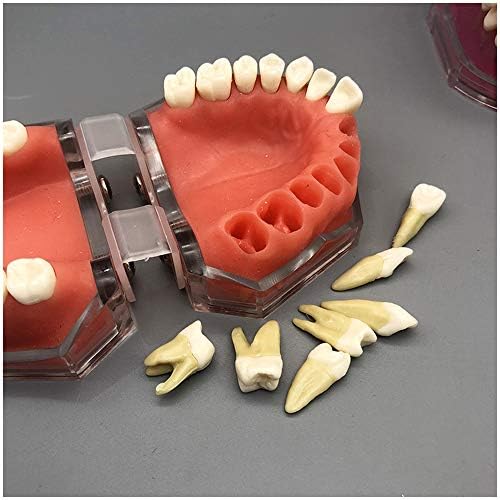 Модел на заби за заби KH66ZKY - Модел на заби за заби - Стандарден студиски настава за стоматолошки режим со 28 парчиња сите отстранливи