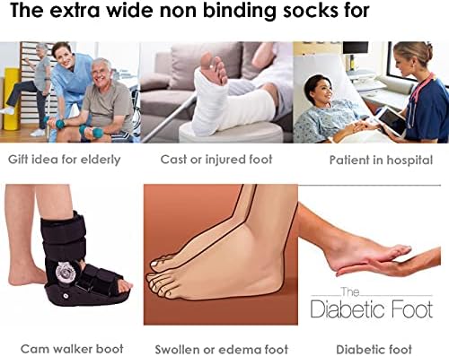Дополнителни широки чорапи за лимфедем отечени нозе нога, баријатриски чорапи, медицински леано чорап, дијабетични не -врзувачки чорапи - преголема