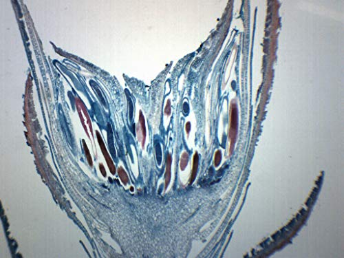Мос Антеридија, надолжен дел - Подготвен слајд на микроскоп - 75 x 25мм - Биологија и микроскопија - лаборатории на Еиско