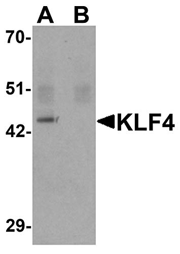 КЛФ4 Антитела [4Г6Е11]