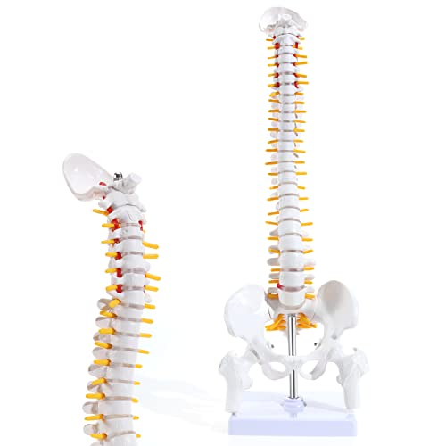 Asintod моделот на лумбалниот 'рбет, анатомски модел со големина на живот на лумбалниот' рбет, лумбосакралниот сегмент со нерви и хернијација