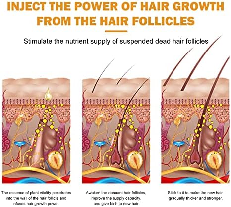 Густа коса навлажнувачки густа анти -фрлање фиксна коса поправка на косата за коса од корен за коса 60мл ролетни