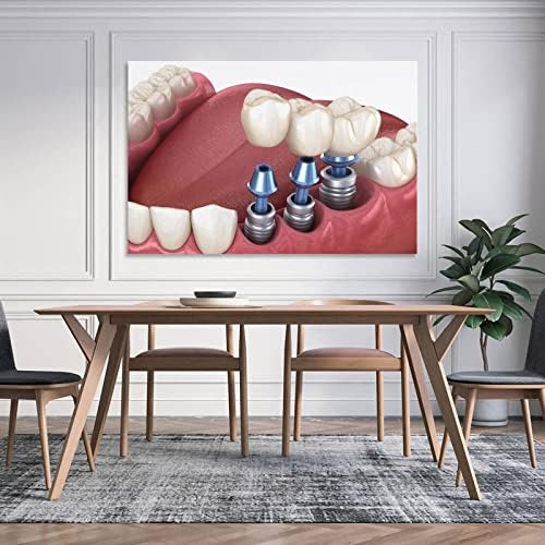Фотографии на wallsидовите на стоматолошките болници, украси во стоматолошки канцеларии, стоматолошка нега, ортодонт, платно wallидни уметности